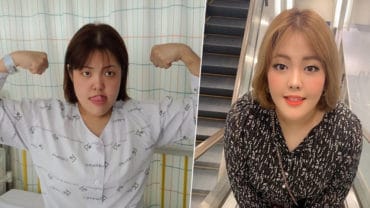 ยาง ซูบิน ไอดอลสายกินชาวเกาหลี ตรวจพบมะเร็งต่อมไทรอยด์