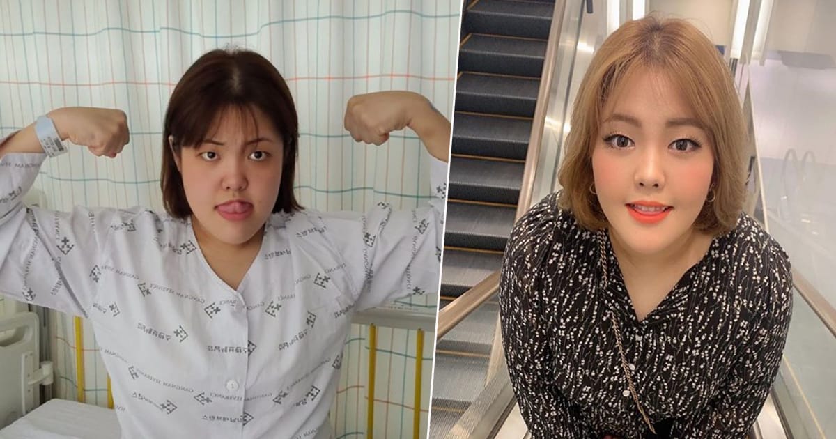 ยาง ซูบิน ไอดอลสายกินชาวเกาหลี ตรวจพบมะเร็งต่อมไทรอยด์